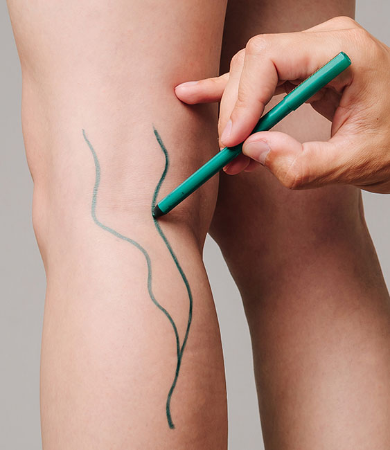 Premier Vascular Institute